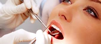 Diş Kaplama Nedir ve Çeşitleri Nelerdir ?